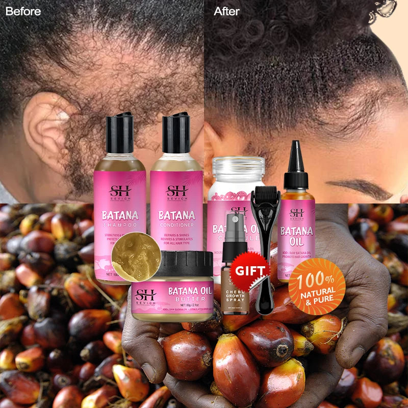 5PCS 100% Batana oil hair growth set African fast hair growth batana Hair Mask Anti hair loss break hair regrowth treatment